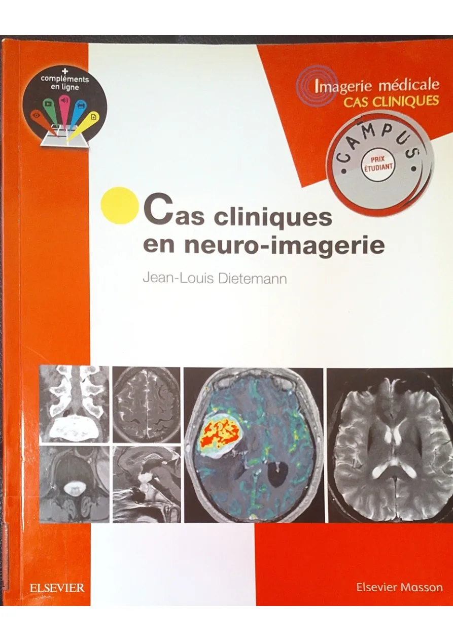 Couverture de Cas cliniques en neuro -imagerie