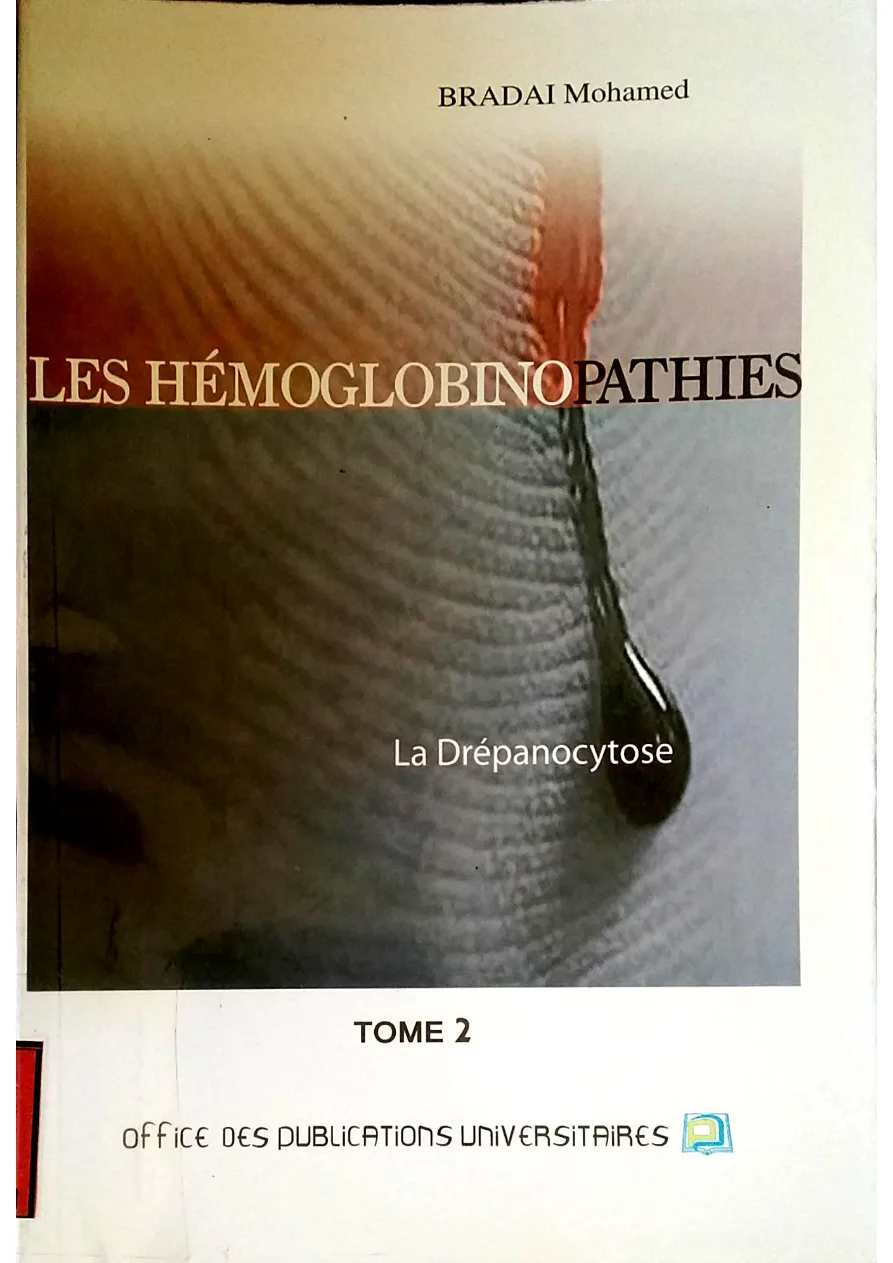 Couverture de Les Hémoglobinopathies .tome 2 : la drépanocytose.