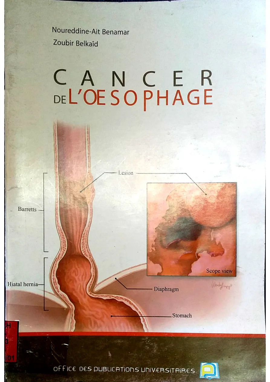 Couverture de Cancer de l'oesophage